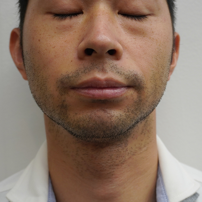Before