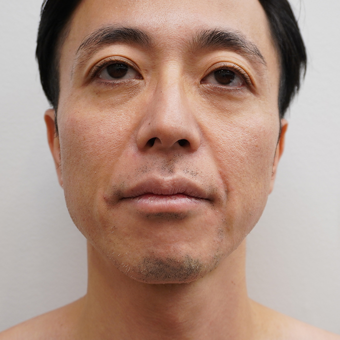 After