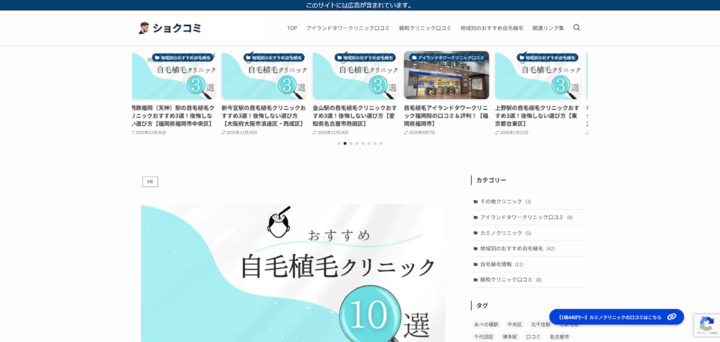 自毛植毛クリニックおすすめ10選!後悔しない選び方